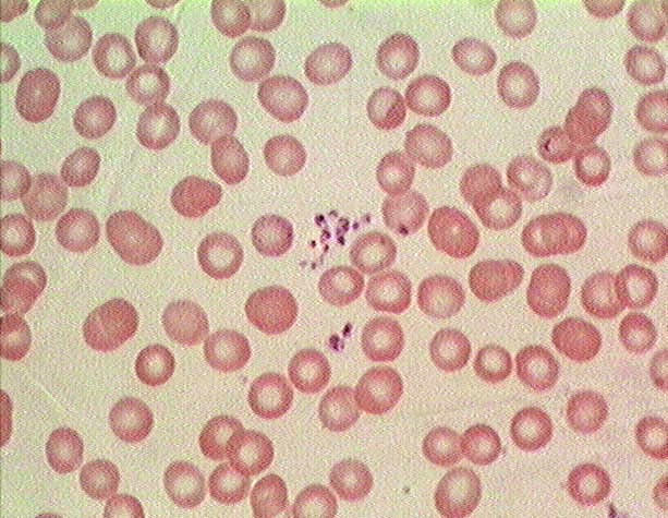 red blood cell microscope 100x