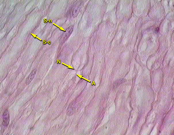 schwann cell histology