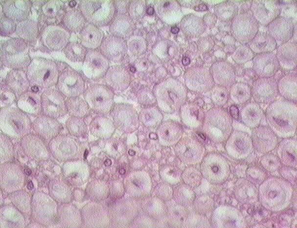 schwann cell histology